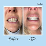 Keeko Botanical Teeth Whitening Pen