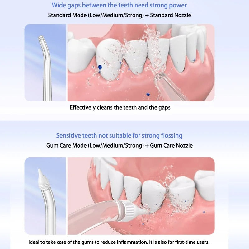 Soocas W1 Portable Oral Irrigator